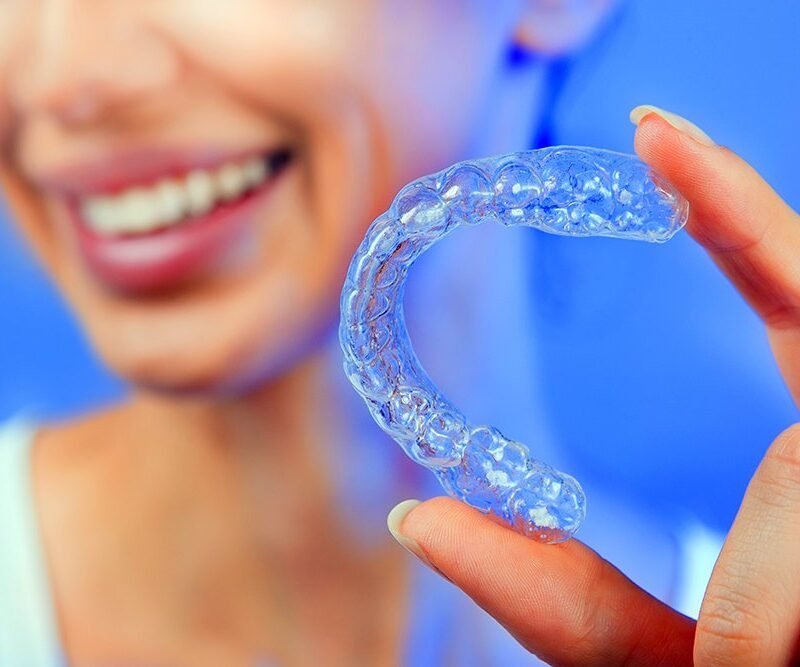 Beautiful Smiling Girl with Tooth Tray (hands Holding Individual Tooth Tray) Methods of Teeth Teeth Whitening and Correction Close-up (blue filter effect)